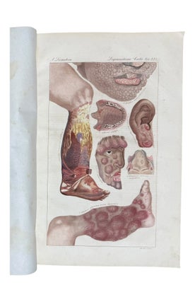 Ikonographische Darstellung der nicht-syphilitischen Hautkrankheiten. Mit darauf bezüglichem systematischem Texte.