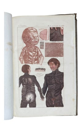 Ikonographische Darstellung der nicht-syphilitischen Hautkrankheiten. Mit darauf bezüglichem systematischem Texte.