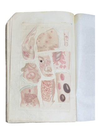 Ikonographische Darstellung der nicht-syphilitischen Hautkrankheiten. Mit darauf bez&uuml;glichem systematischem Texte.