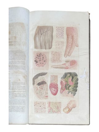 Ikonographische Darstellung der nicht-syphilitischen Hautkrankheiten. Mit darauf bez&uuml;glichem systematischem Texte.