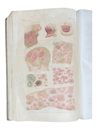 Ikonographische Darstellung der nicht-syphilitischen Hautkrankheiten. Mit darauf bezüglichem systematischem Texte.